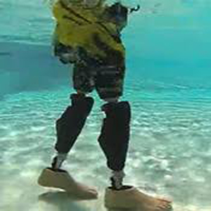 Microprocessor Control Prosthesis